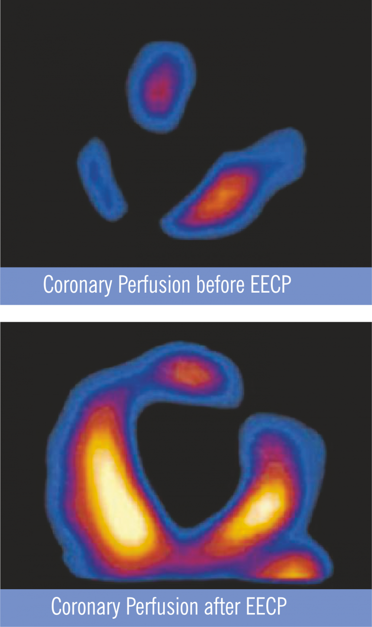 eecp8-768x1292